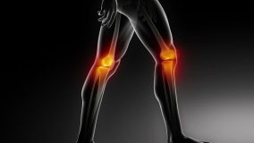 Walking man knee medical scan